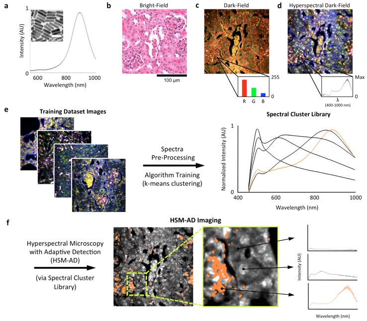 Hyperspectral Dark-Field Microscopy in vivo tracking of nanoparticles