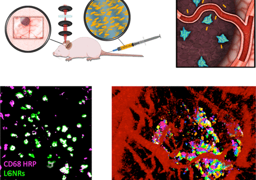 MOZART functional lymph and brain vessel OCT imaging with gold nanorods