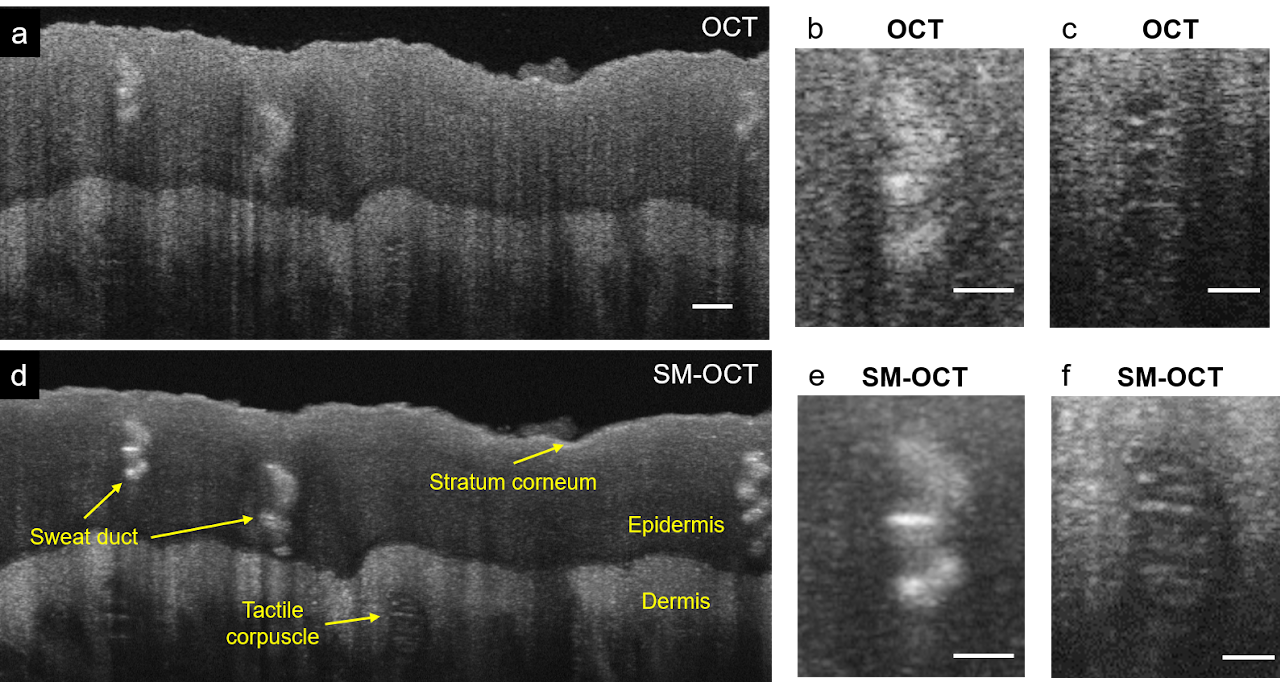 Speckle-Modulating OCT high-resolution imaging