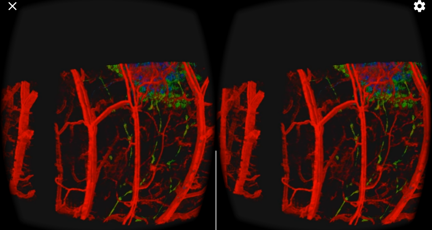 Virtual Reality Volumetric Medical Image Inspection